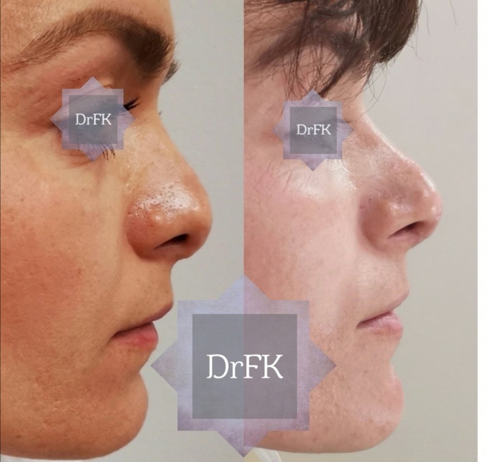 Dr Fotios Filippos Karantonis Plastic Surgery - Dr Fotios Filippos Karantonis Plastic Surgery