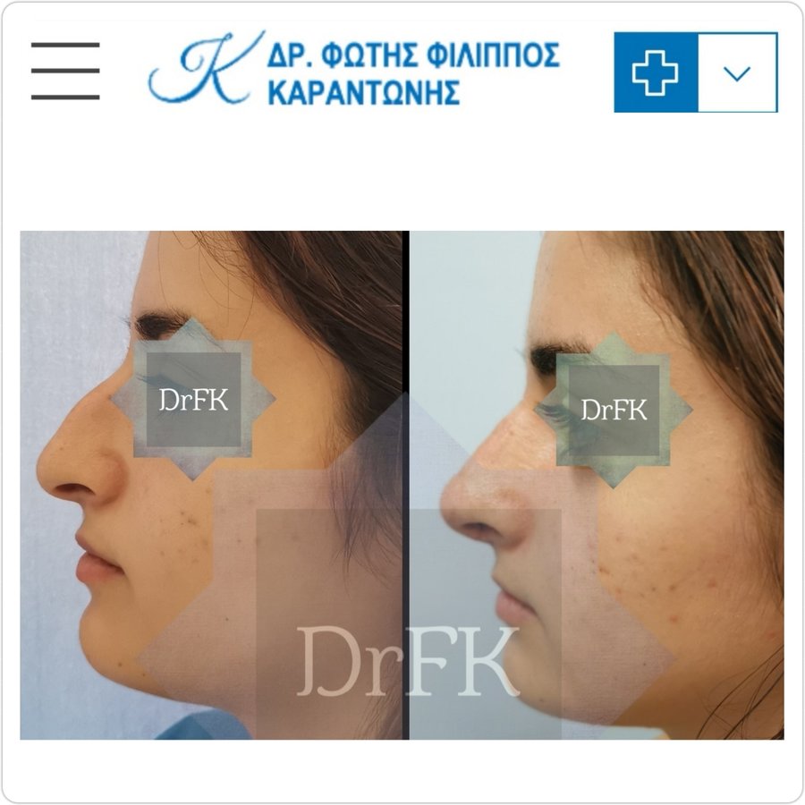 Dr Fotios Filippos Karantonis Plastic Surgery - Dr Fotios Filippos Karantonis Plastic Surgery