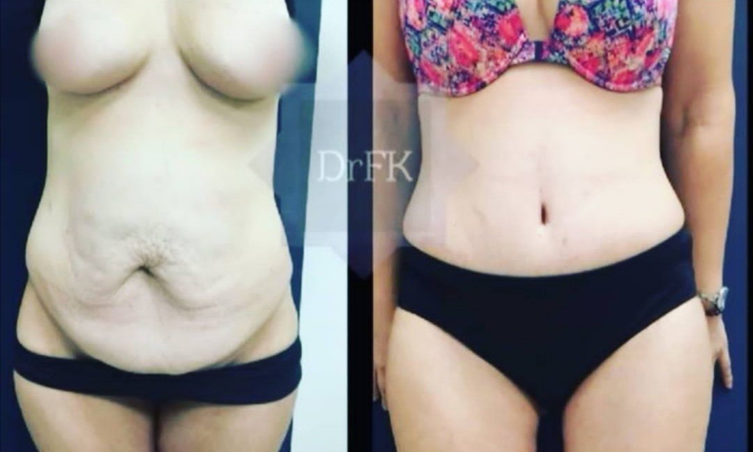 Dr Fotios Filippos Karantonis Plastic Surgery - Dr Fotios Filippos Karantonis Plastic Surgery