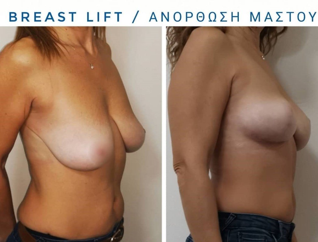 Dr Fotios Filippos Karantonis Plastic Surgery - Dr Fotios Filippos Karantonis Plastic Surgery