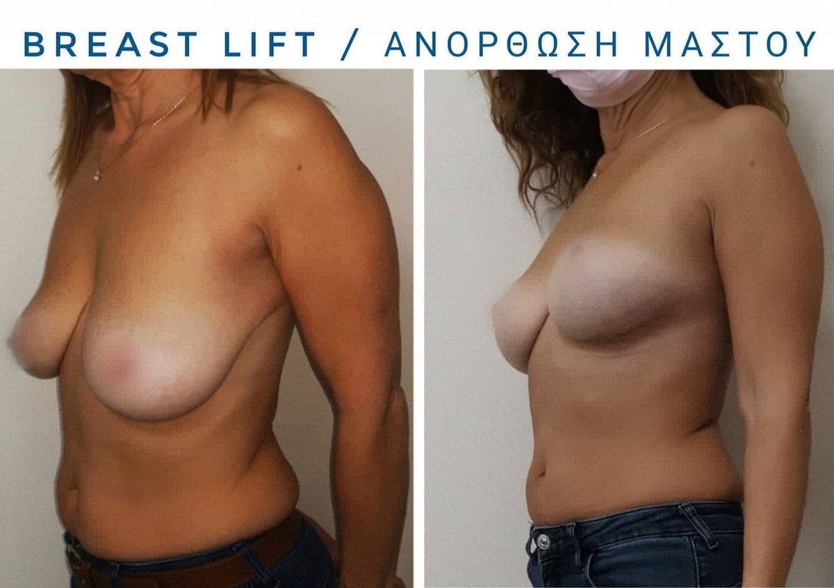 Dr Fotios Filippos Karantonis Plastic Surgery - Dr Fotios Filippos Karantonis Plastic Surgery