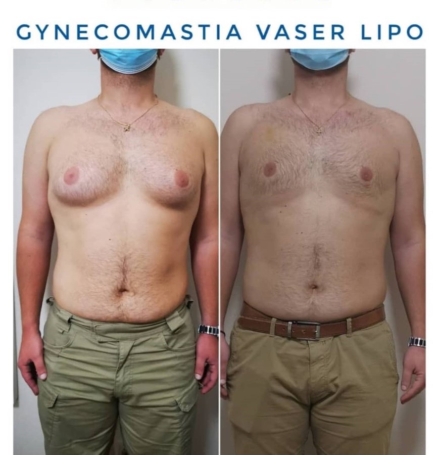 Dr Fotios Filippos Karantonis Plastic Surgery - Dr Fotios Filippos Karantonis Plastic Surgery