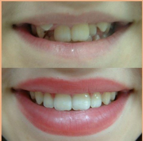 عيادة الدكتور جورج شيب لتقويم الأسنان - Dr Georges Scheib Orthodontic Clinic