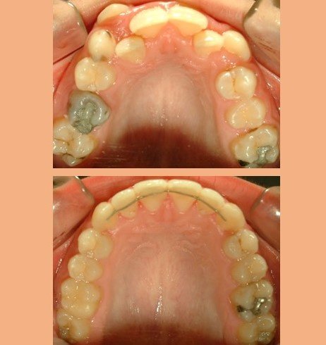 عيادة الدكتور جورج شيب لتقويم الأسنان - Dr Georges Scheib Orthodontic Clinic