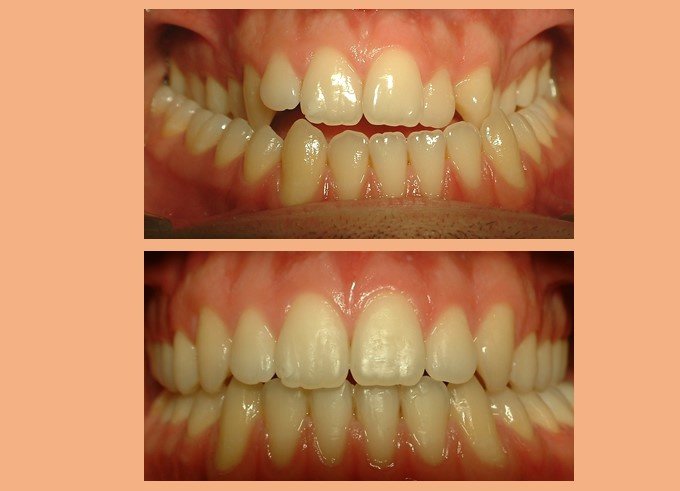 عيادة الدكتور جورج شيب لتقويم الأسنان - Dr Georges Scheib Orthodontic Clinic