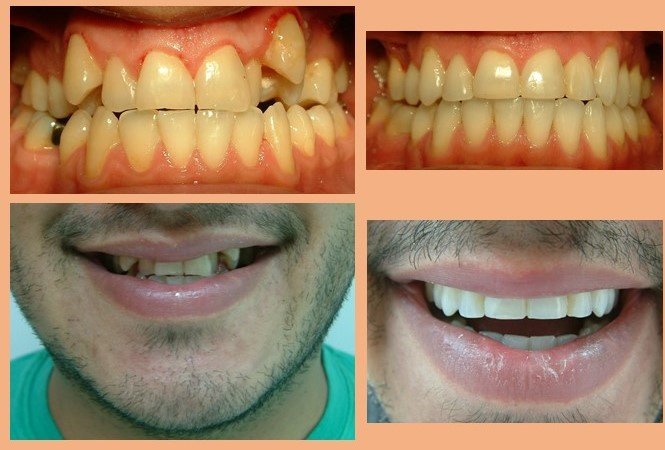 عيادة الدكتور جورج شيب لتقويم الأسنان - Dr Georges Scheib Orthodontic Clinic