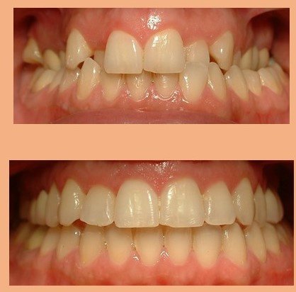 عيادة الدكتور جورج شيب لتقويم الأسنان - Dr Georges Scheib Orthodontic Clinic