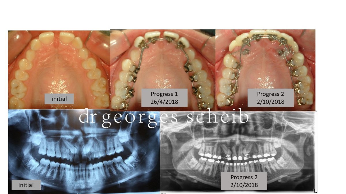 عيادة الدكتور جورج شيب لتقويم الأسنان - Dr Georges Scheib Orthodontic Clinic