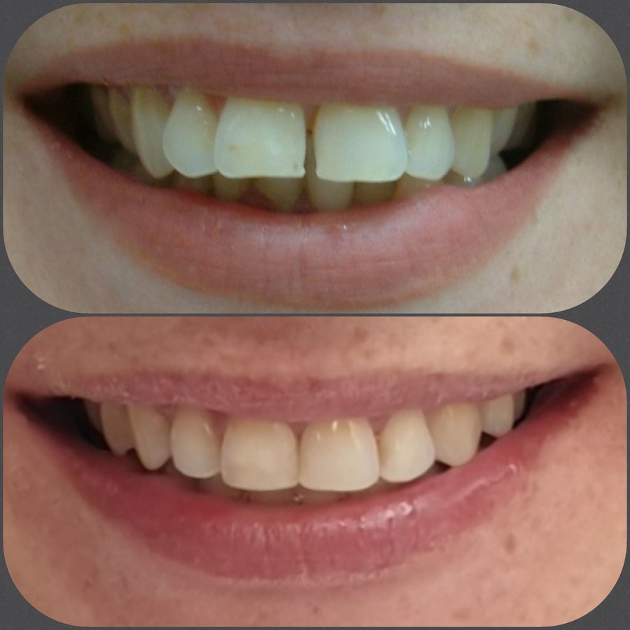 عيادة الدكتور جورج شيب لتقويم الأسنان - Dr Georges Scheib Orthodontic Clinic