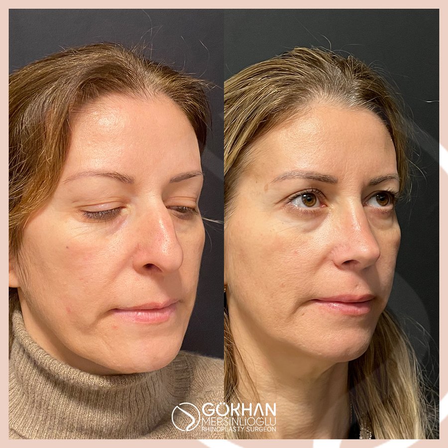 Dr. Gökhan Mersinlioğlu - Dr. Gökhan Mersinlioğlu