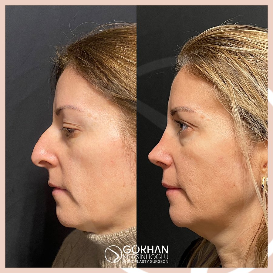 Dr. Gökhan Mersinlioğlu - Dr. Gökhan Mersinlioğlu