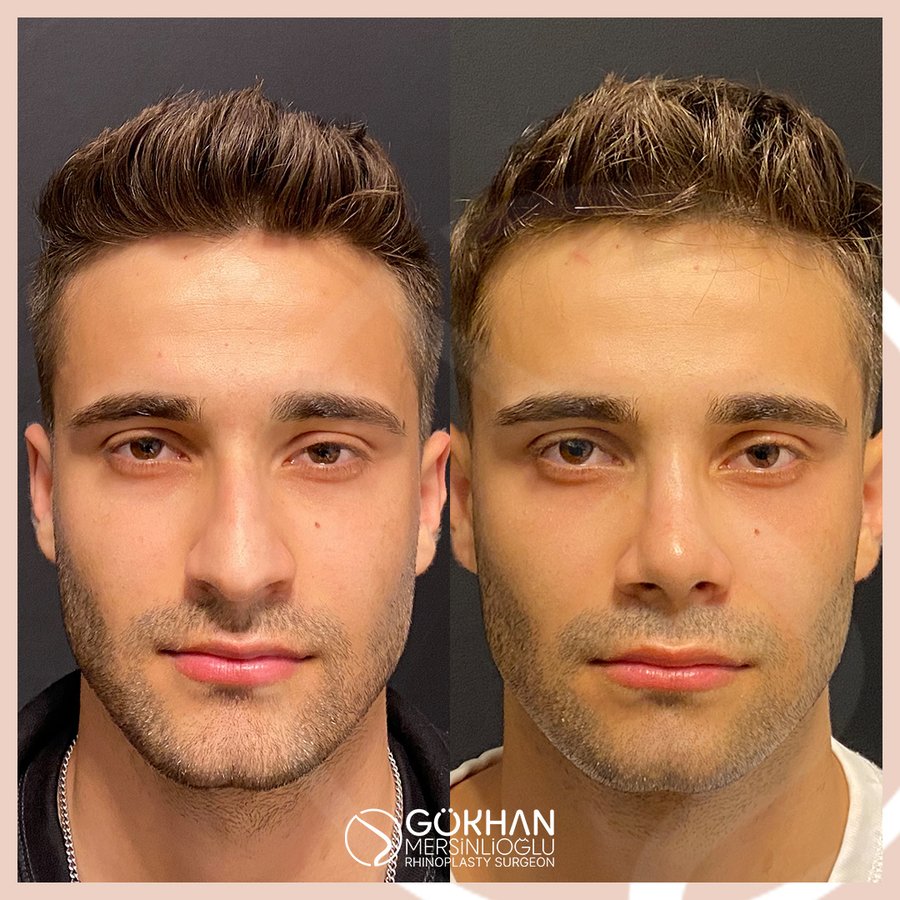 Dr. Gökhan Mersinlioğlu - Dr. Gökhan Mersinlioğlu