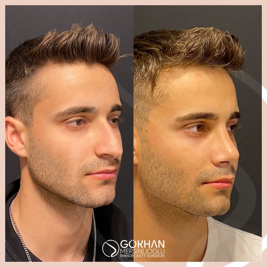 Dr. Gökhan Mersinlioğlu - Dr. Gökhan Mersinlioğlu