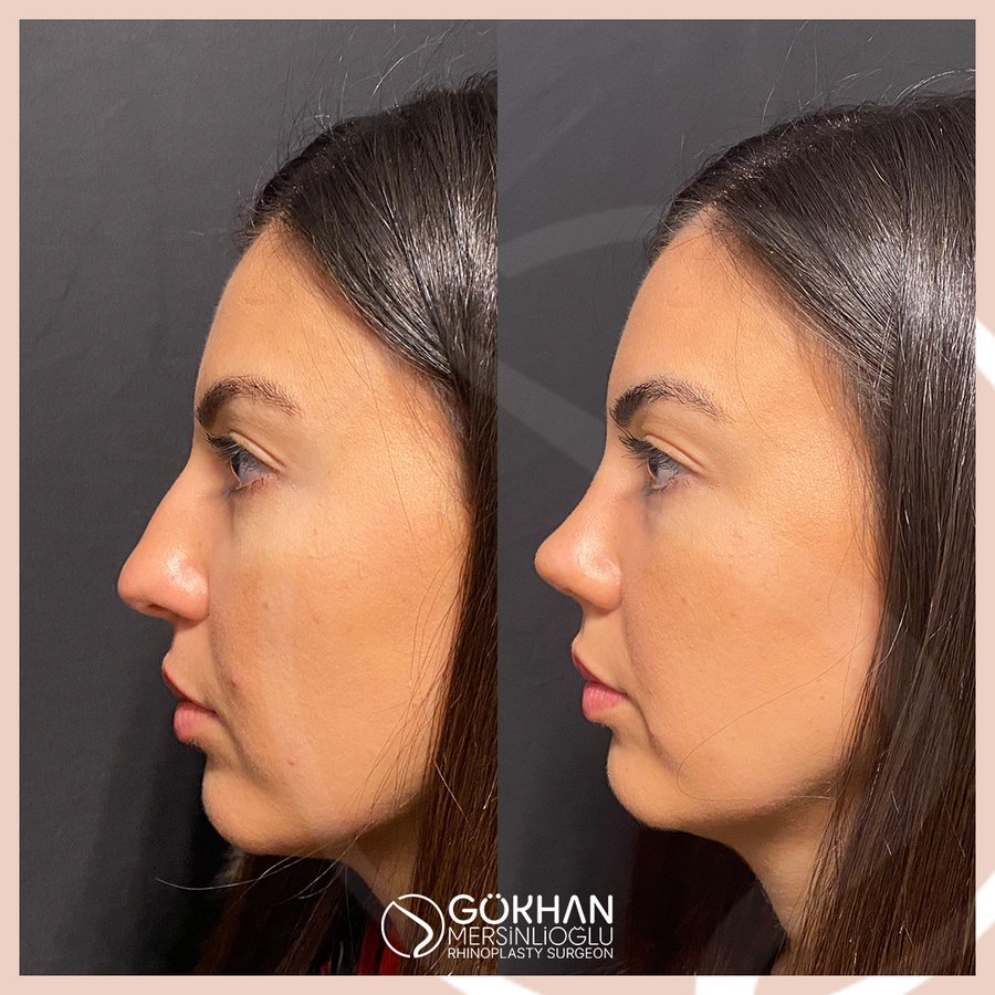 Dr. Gökhan Mersinlioğlu - Dr. Gökhan Mersinlioğlu