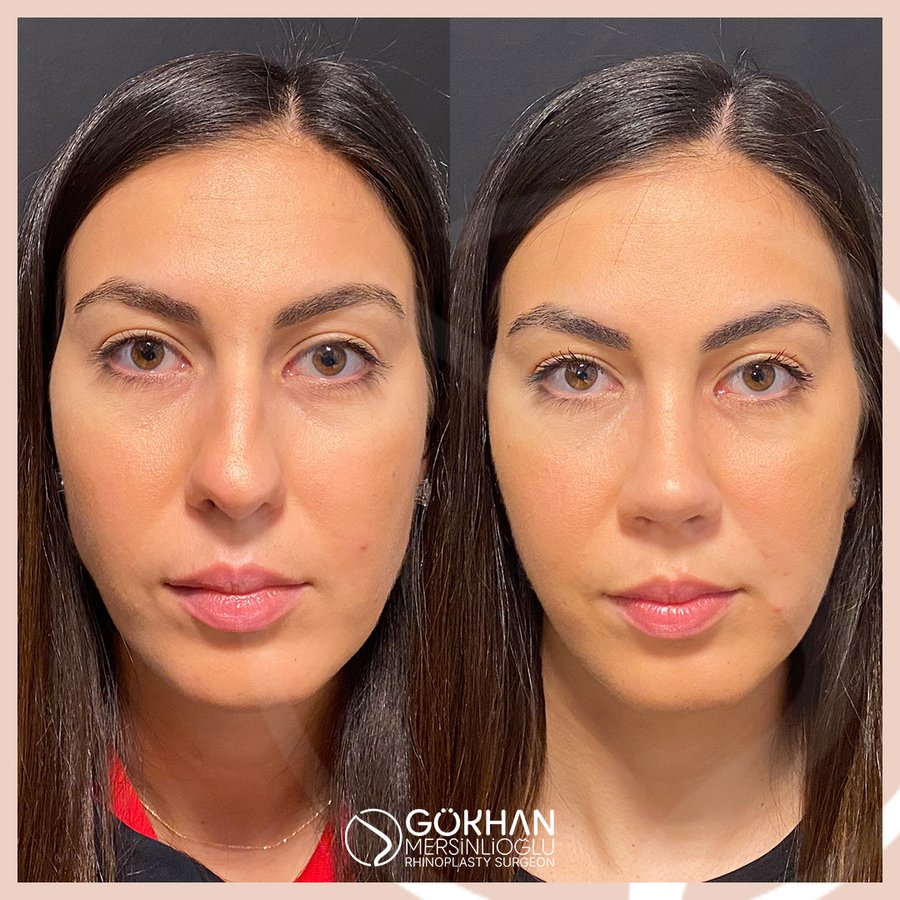 Dr. Gökhan Mersinlioğlu - Dr. Gökhan Mersinlioğlu