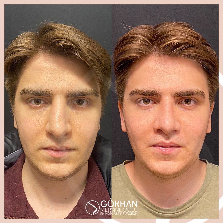 Dr. Gökhan Mersinlioğlu - Dr. Gökhan Mersinlioğlu