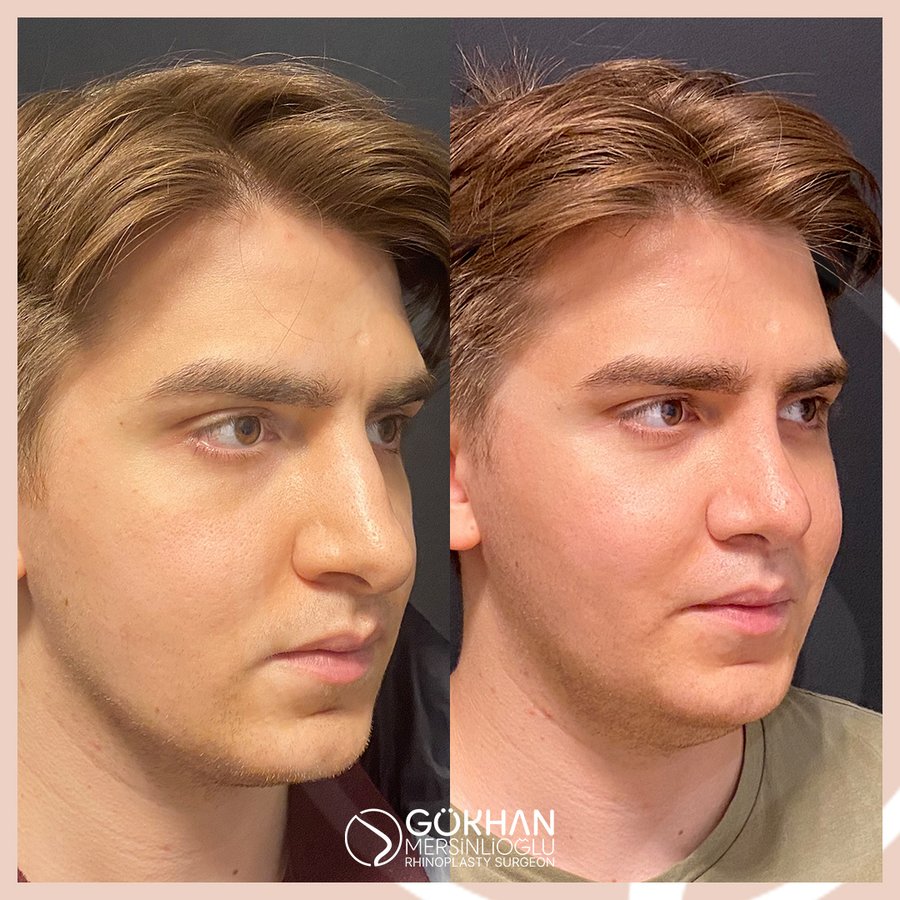 Dr. Gökhan Mersinlioğlu - Dr. Gökhan Mersinlioğlu