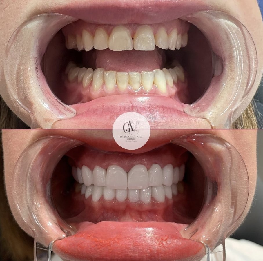 Dr. Görkem Atsal Clinic - Dr. Görkem Atsal Clinic