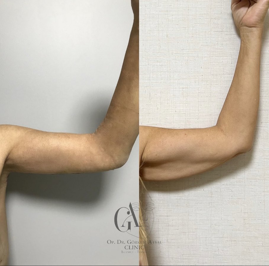 Dr. Görkem Atsal Clinic - Dr. Görkem Atsal Clinic