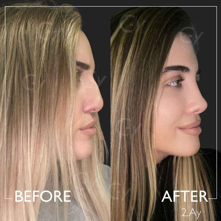 Dr. Guray Yesiladali Clinic - Dr. Guray Yesiladali Clinic