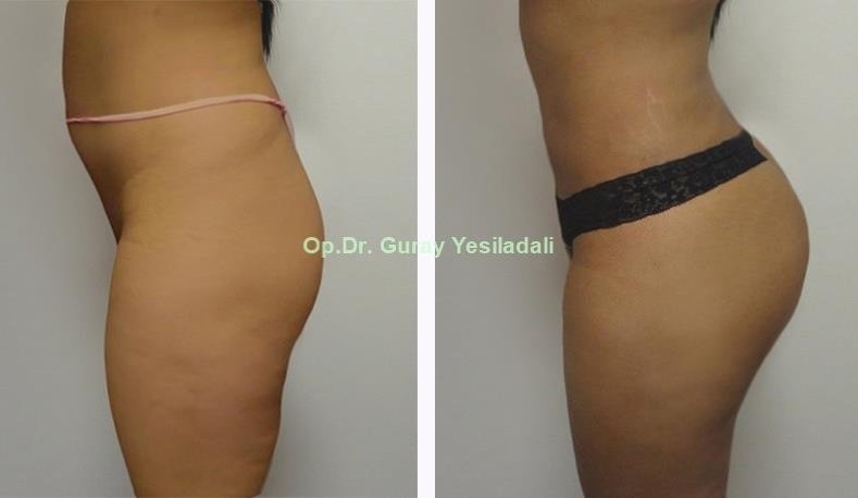 Dr. Guray Yesiladali Clinic - Dr. Guray Yesiladali Clinic