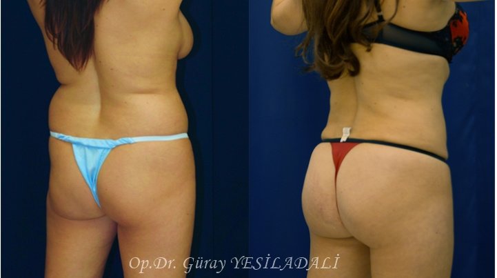 Dr. Guray Yesiladali Clinic - Dr. Guray Yesiladali Clinic