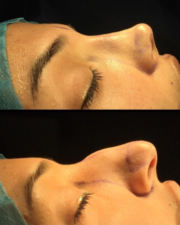 Dr. Guray Yesiladali Clinic - Dr. Guray Yesiladali Clinic