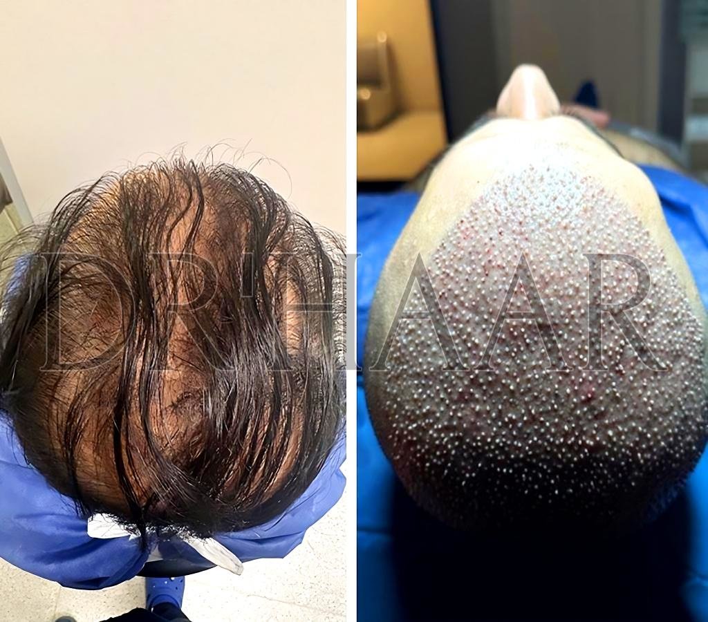 Dr Haar Hair Transplant & Plastic Surgery Clinic - Dr Haar Hair Transplant & Plastic Surgery Clinic