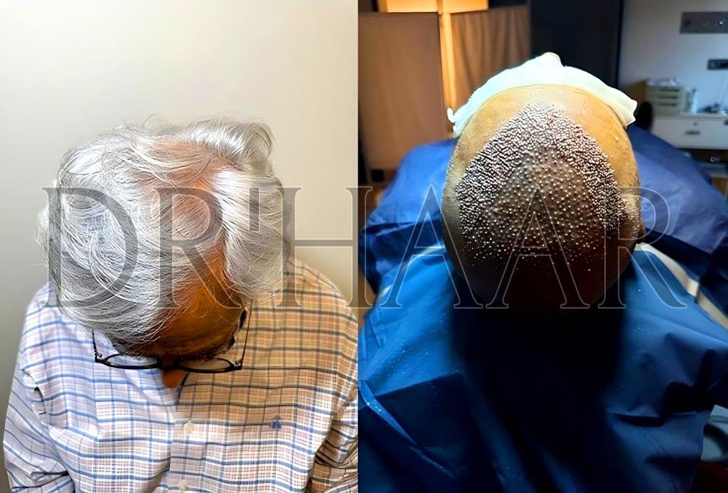 Dr Haar Hair Transplant & Plastic Surgery Clinic - Dr Haar Hair Transplant & Plastic Surgery Clinic