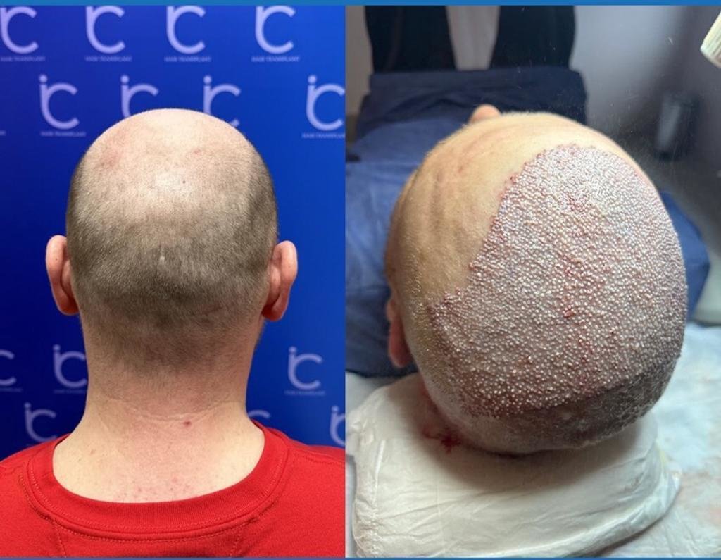 Dr Haar Hair Transplant & Plastic Surgery Clinic - Dr Haar Hair Transplant & Plastic Surgery Clinic