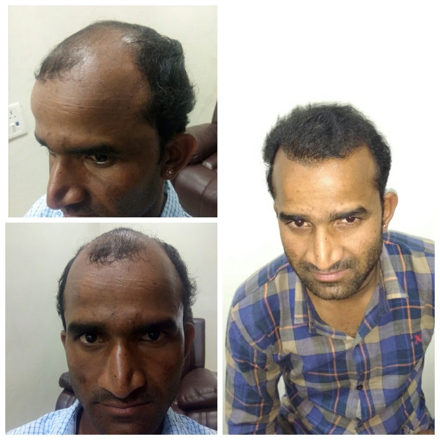 Dr. Hair Clinic - Dr. Hair Clinic