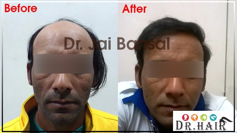 Dr. Hair Clinic - Dr. Hair Clinic