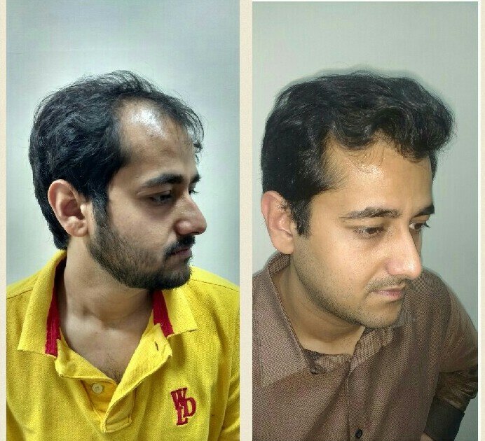 Dr. Hair Clinic - Dr. Hair Clinic