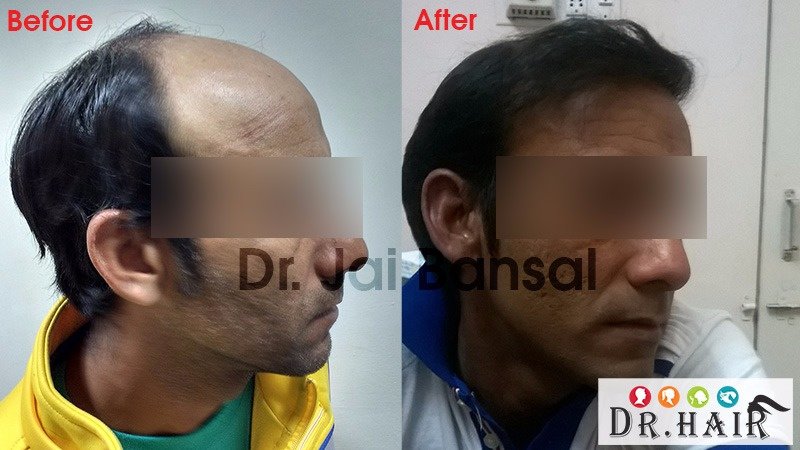 Dr. Hair Clinic - Dr. Hair Clinic