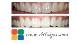 Dr. Javier Trejos - Orthodontics - Royal Center - Dr. Javier Trejos - Orthodontics - Royal Center