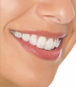 Dr. Javier Trejos - Orthodontics - Royal Center - Dr. Javier Trejos - Orthodontics - Royal Center