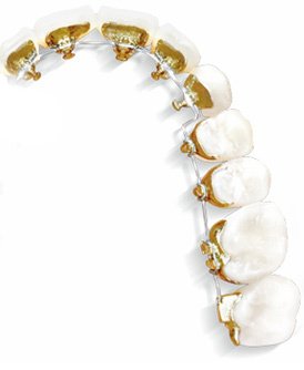 Dr. Javier Trejos - Orthodontics - Royal Center - Dr. Javier Trejos - Orthodontics - Royal Center