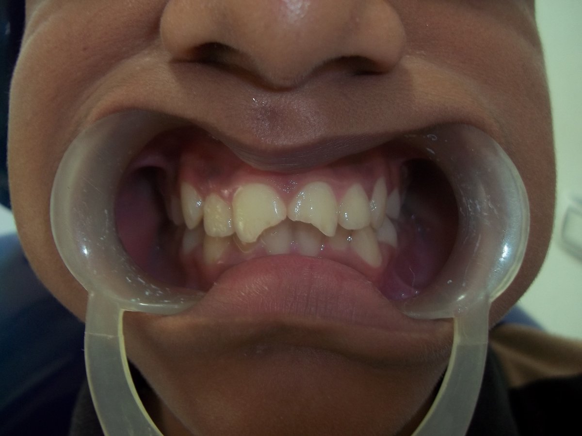 Dr. Jessal Dental Clinic, Cochin - Dr. Jessal Dental Clinic, Cochin