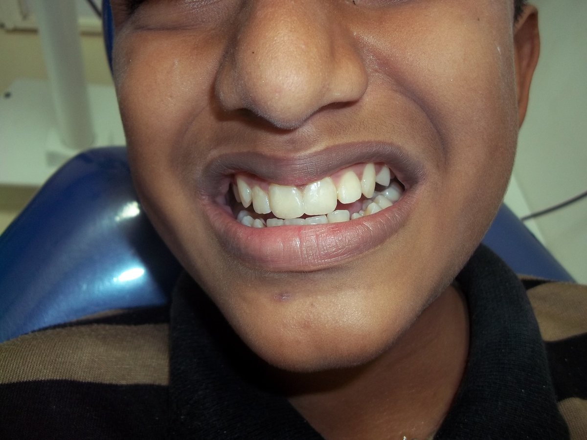 Dr. Jessal Dental Clinic, Cochin - Dr. Jessal Dental Clinic, Cochin