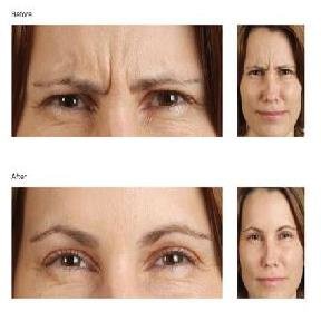 Dr. John Kartsonis - Dr. John Kartsonis