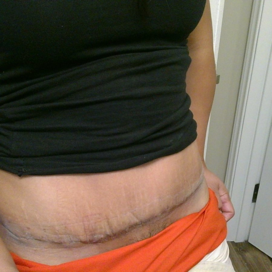 Dr. Jorge Mejia - Dr. Jorge Mejia