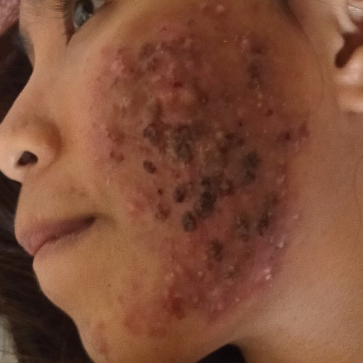 Dr. Joyce C. Castillo - Dr. Joyce C. Castillo