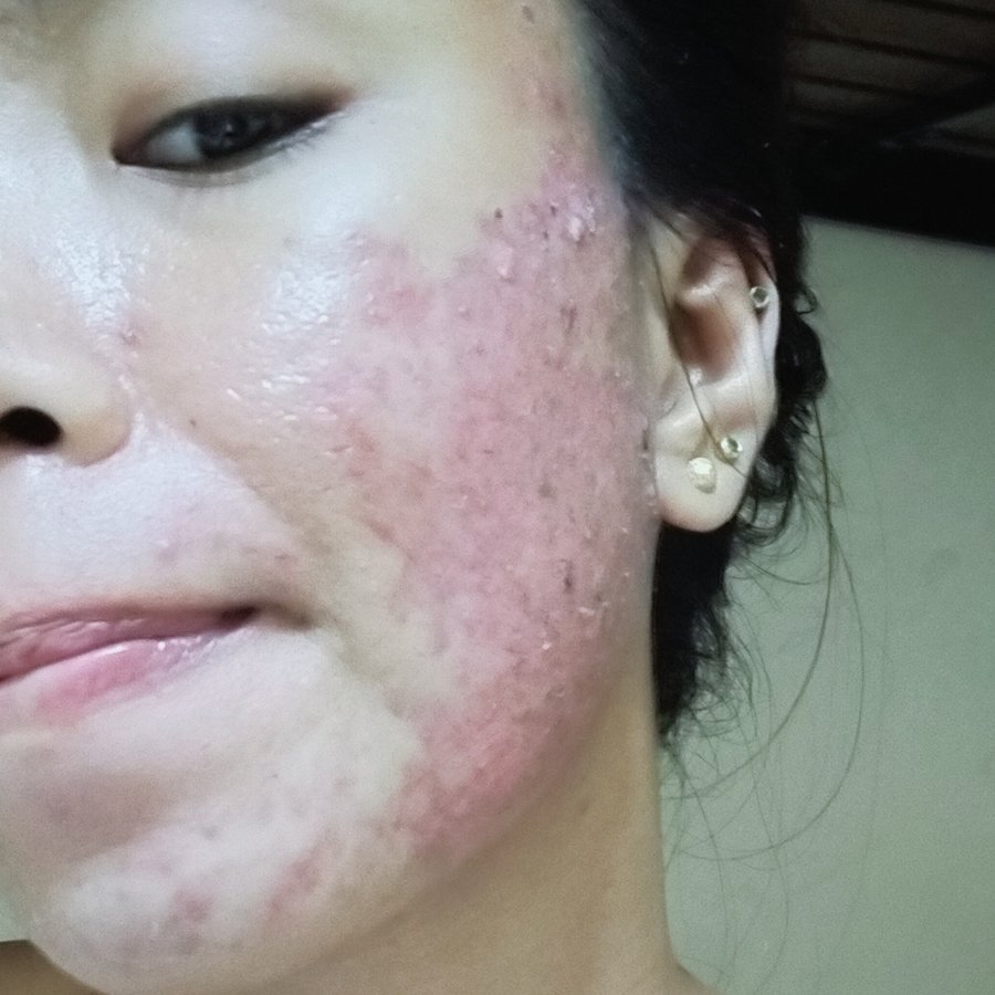 Dr. Joyce C. Castillo - Dr. Joyce C. Castillo