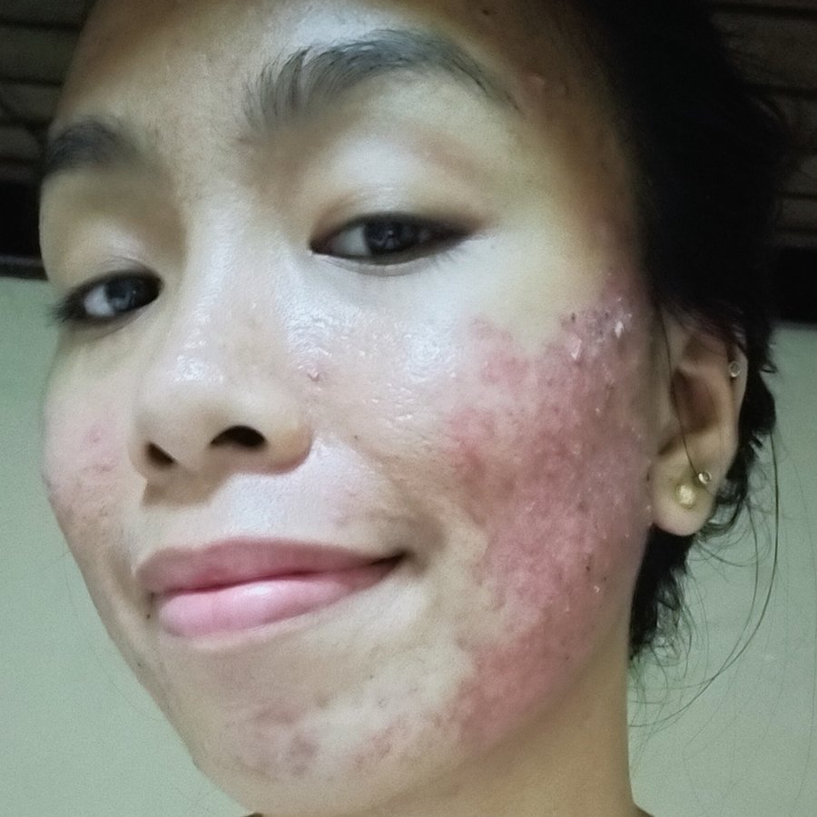 Dr. Joyce C. Castillo - Dr. Joyce C. Castillo