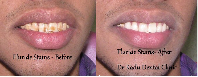 Dr. Kadu's Orthodontic And Dental Clinic - Dr. Kadu's Orthodontic And Dental Clinic