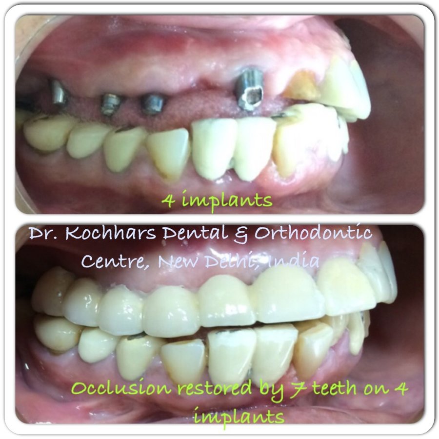 مركز الدكتور كوشار لطب الأسنان وتقويم الأسنان - Dr Kochhars Children| Dental & Orthodontic Centre