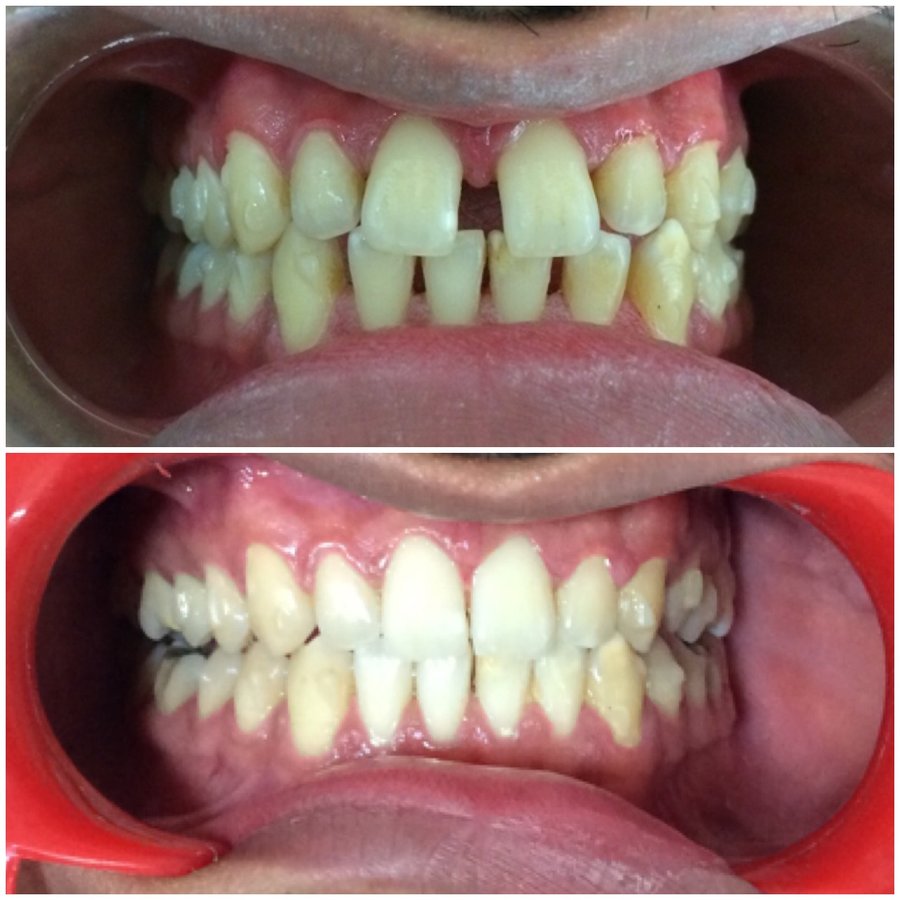 مركز الدكتور كوشار لطب الأسنان وتقويم الأسنان - Dr Kochhars Children| Dental & Orthodontic Centre