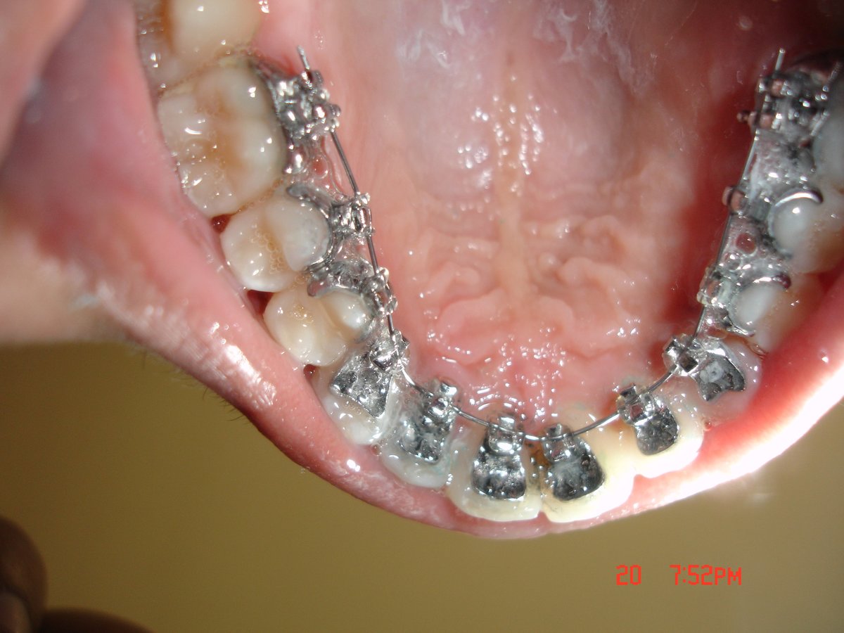 مركز الدكتور كوشار لطب الأسنان وتقويم الأسنان - Dr Kochhars Children| Dental & Orthodontic Centre