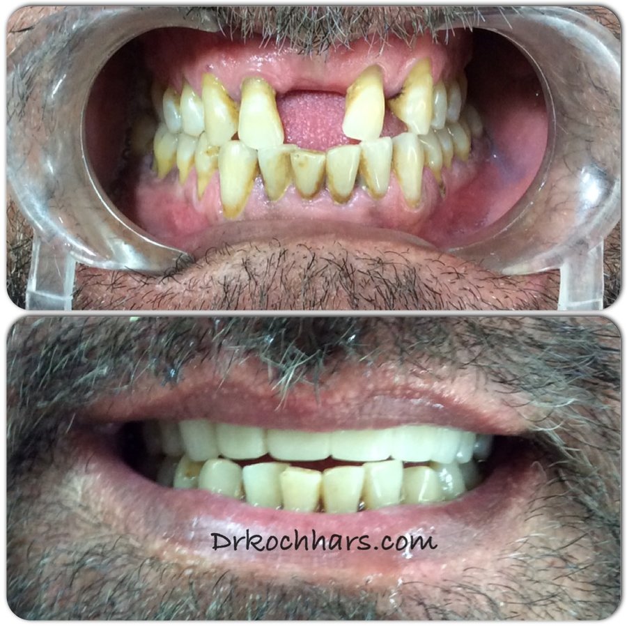 مركز الدكتور كوشار لطب الأسنان وتقويم الأسنان - Dr Kochhars Children| Dental & Orthodontic Centre