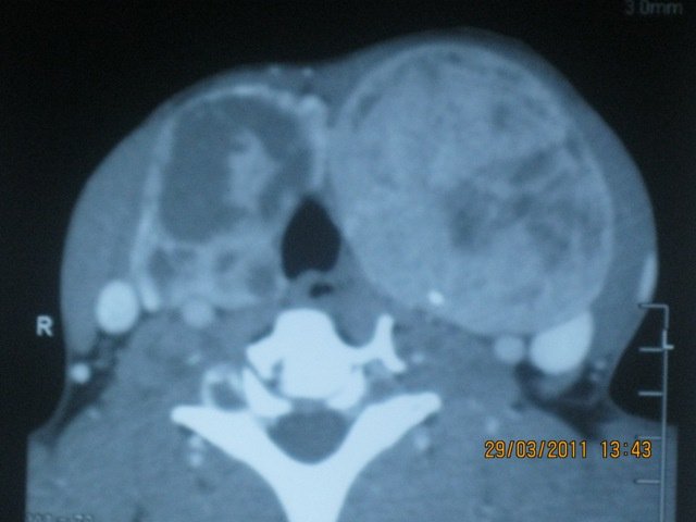 Dr Kumaresh ENT Clinic - Dr Kumaresh ENT Clinic